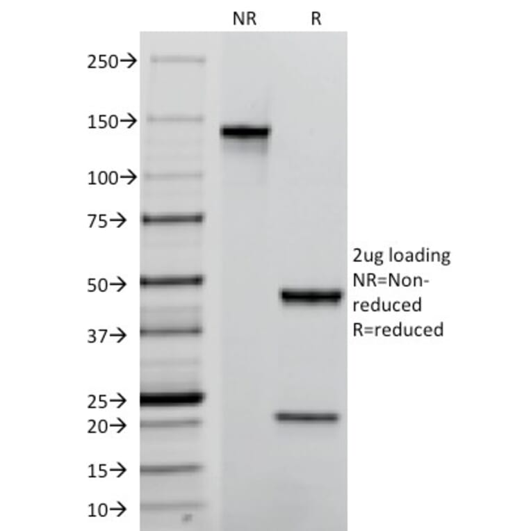 SDS-PAGE - Anti-TROP2 Antibody [TACSTD2/2152] - BSA and Azide free (A252420) - Antibodies.com