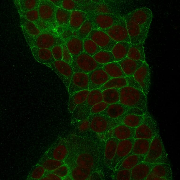 Immunofluorescence - Anti-TROP2 Antibody [TACSTD2/2152] - BSA and Azide free (A252420) - Antibodies.com