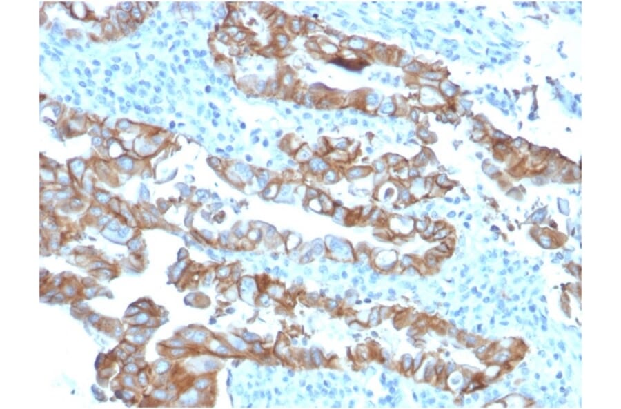 Immunohistochemistry - Anti-TROP2 Antibody [TACSTD2/2153] - BSA and Azide free (A252421) - Antibodies.com