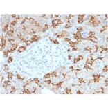 Immunohistochemistry - Anti-TROP2 Antibody [TACSTD2/2153] - BSA and Azide free (A252421) - Antibodies.com