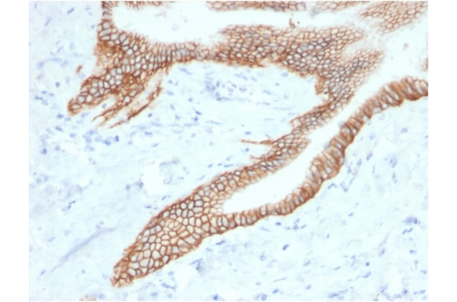 Immunohistochemistry - Anti-TROP2 Antibody [TACSTD2/2153] - BSA and Azide free (A252421) - Antibodies.com
