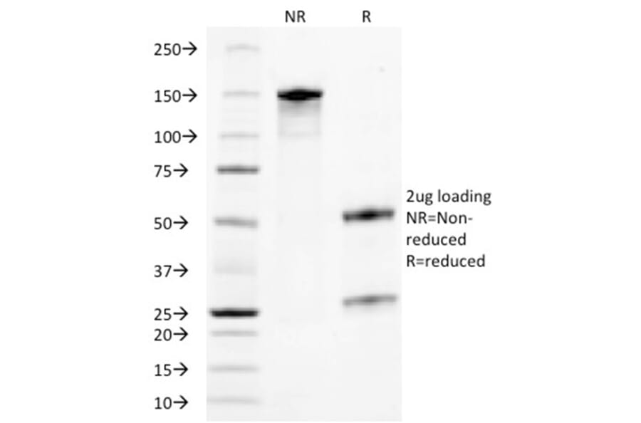 SDS-PAGE - Anti-TROP2 Antibody [TACSTD2/2153] - BSA and Azide free (A252421) - Antibodies.com