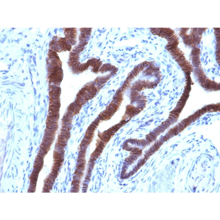 Immunohistochemistry - Anti-EpCAM Antibody [EGP40/1110] - BSA and Azide free (A252423) - Antibodies.com