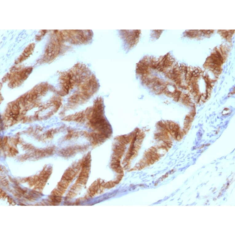Immunohistochemistry - Anti-EpCAM Antibody [EGP40/1110] - BSA and Azide free (A252423) - Antibodies.com