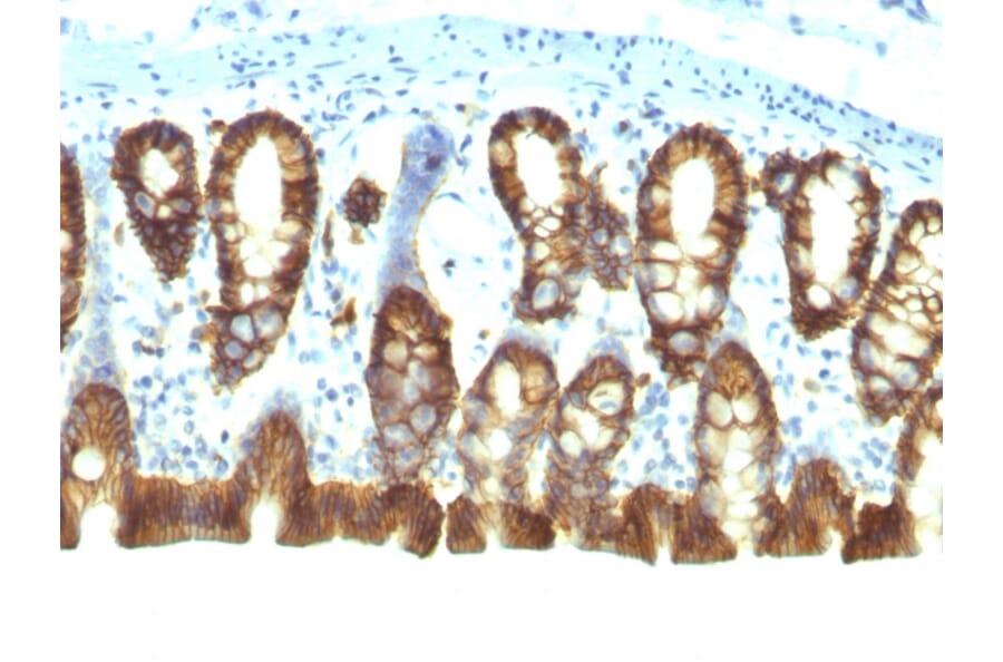 Immunohistochemistry - Anti-EpCAM Antibody [EGP40/1110] - BSA and Azide free (A252423) - Antibodies.com