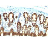 Immunohistochemistry - Anti-EpCAM Antibody [EGP40/1110] - BSA and Azide free (A252423) - Antibodies.com