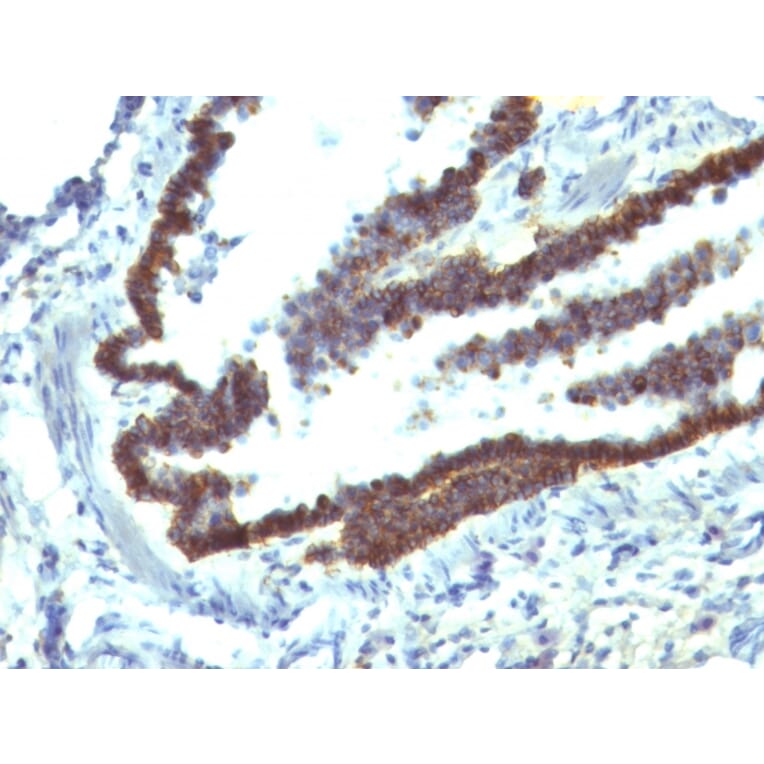 Immunohistochemistry - Anti-EpCAM Antibody [EGP40/1110] - BSA and Azide free (A252423) - Antibodies.com