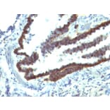 Immunohistochemistry - Anti-EpCAM Antibody [EGP40/1110] - BSA and Azide free (A252423) - Antibodies.com