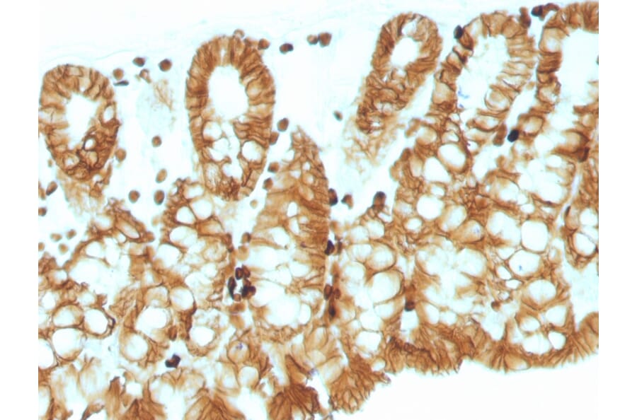 Immunohistochemistry - Anti-EpCAM Antibody [EGP40/1110] - BSA and Azide free (A252423) - Antibodies.com