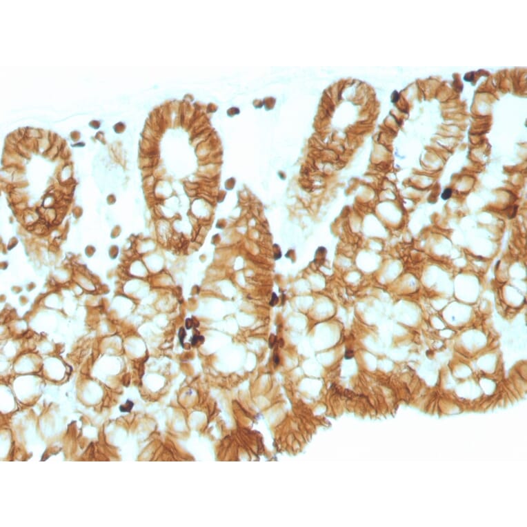 Immunohistochemistry - Anti-EpCAM Antibody [EGP40/1110] - BSA and Azide free (A252423) - Antibodies.com