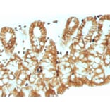 Immunohistochemistry - Anti-EpCAM Antibody [EGP40/1110] - BSA and Azide free (A252423) - Antibodies.com