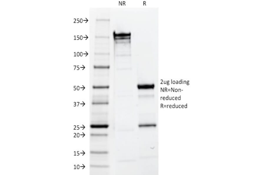 SDS-PAGE - Anti-EpCAM Antibody [EGP40/1110] - BSA and Azide free (A252423) - Antibodies.com