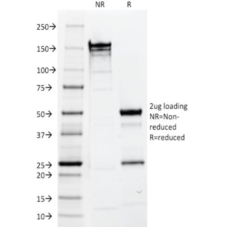 SDS-PAGE - Anti-EpCAM Antibody [EGP40/1110] - BSA and Azide free (A252423) - Antibodies.com