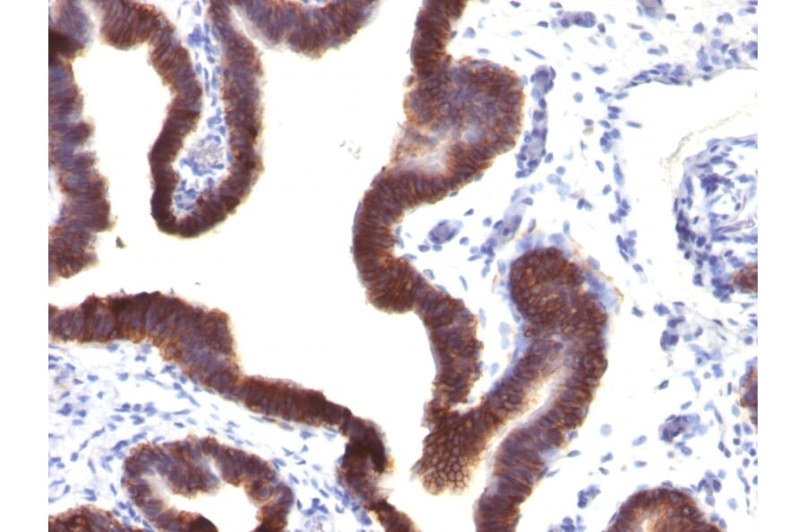 Immunohistochemistry - Anti-EpCAM Antibody [EGP40/1120] - BSA and Azide free (A252423) - Antibodies.com