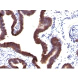 Immunohistochemistry - Anti-EpCAM Antibody [EGP40/1120] - BSA and Azide free (A252423) - Antibodies.com