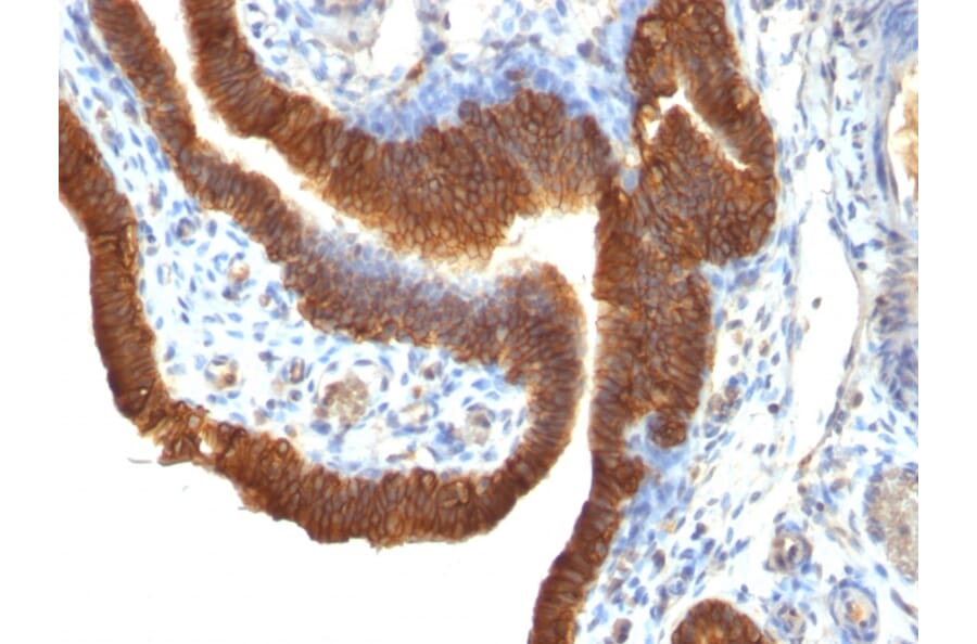 Immunohistochemistry - Anti-EpCAM Antibody [SPM491] - BSA and Azide free (A252424) - Antibodies.com