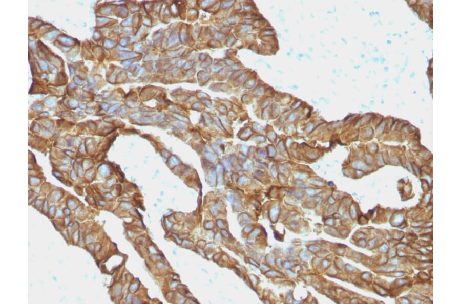 Immunohistochemistry - Anti-EpCAM Antibody [EGP40/1372] - BSA and Azide free (A252426) - Antibodies.com