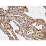 Immunohistochemistry - Anti-EpCAM Antibody [EGP40/1372] - BSA and Azide free (A252426) - Antibodies.com