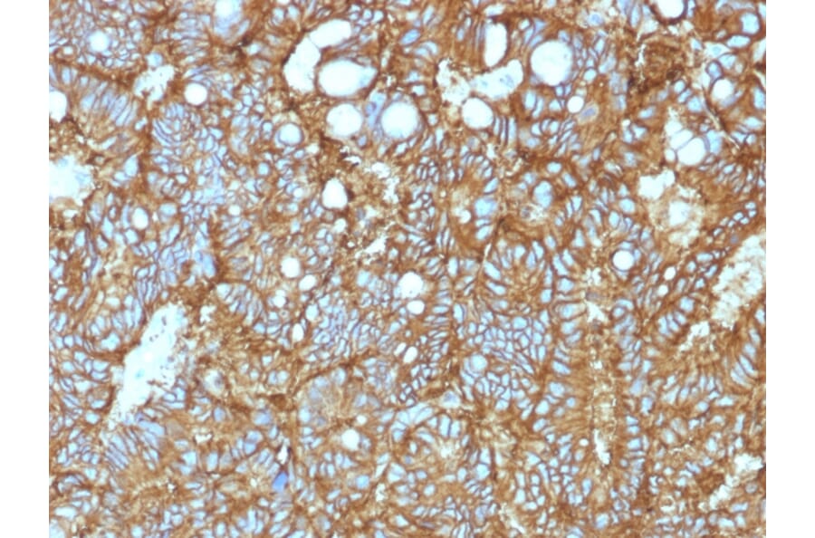Immunohistochemistry - Anti-EpCAM Antibody [EGP40/1372] - BSA and Azide free (A252426) - Antibodies.com