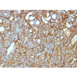 Immunohistochemistry - Anti-EpCAM Antibody [EGP40/1372] - BSA and Azide free (A252426) - Antibodies.com