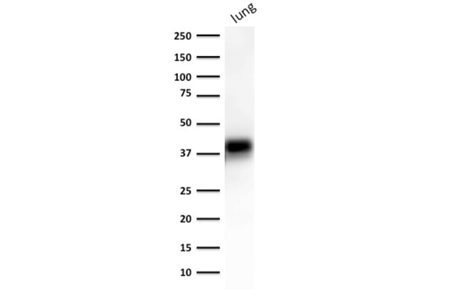Western Blot - Anti-EpCAM Antibody [EGP40/1372] - BSA and Azide free (A252426) - Antibodies.com