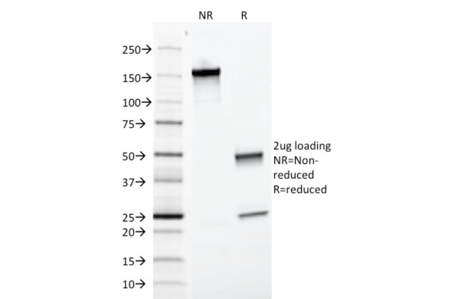 SDS-PAGE - Anti-EpCAM Antibody [EGP40/1372] - BSA and Azide free (A252426) - Antibodies.com