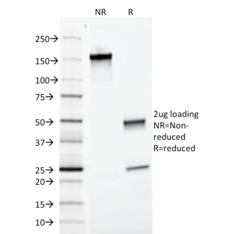 SDS-PAGE - Anti-EpCAM Antibody [EGP40/1372] - BSA and Azide free (A252426) - Antibodies.com