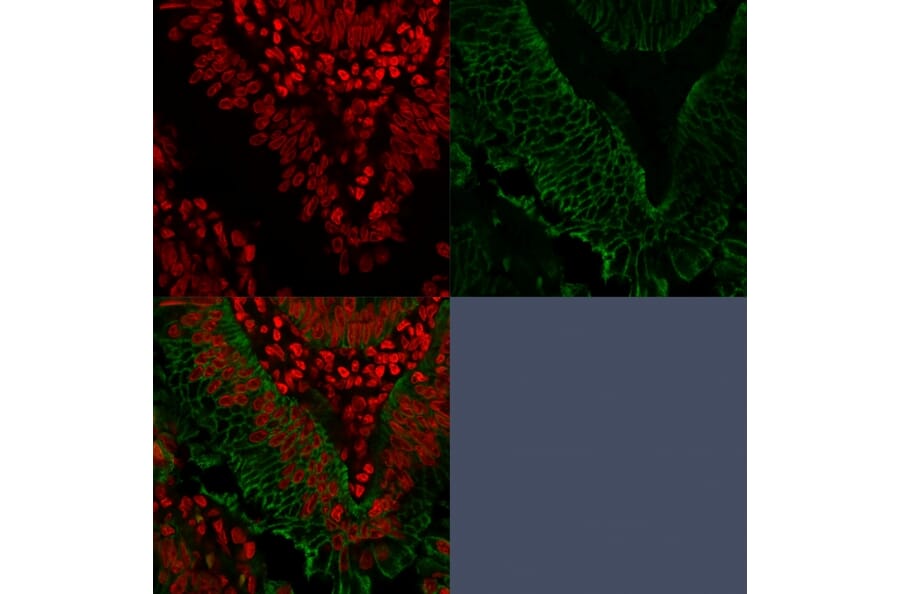 Immunofluorescence - Anti-EpCAM Antibody [EGP40/1372] - BSA and Azide free (A252426) - Antibodies.com