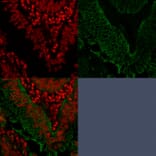 Immunofluorescence - Anti-EpCAM Antibody [EGP40/1372] - BSA and Azide free (A252426) - Antibodies.com