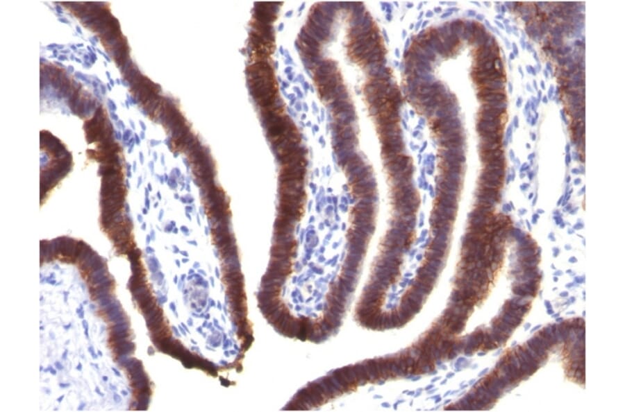 Immunohistochemistry - Anti-EpCAM Antibody [EGP40/1373] - BSA and Azide free (A252427) - Antibodies.com