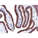 Immunohistochemistry - Anti-EpCAM Antibody [EGP40/1373] - BSA and Azide free (A252427) - Antibodies.com