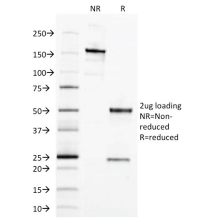 SDS-PAGE - Anti-EpCAM Antibody [EGP40/1373] - BSA and Azide free (A252427) - Antibodies.com