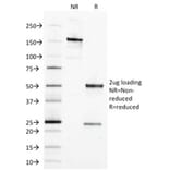 SDS-PAGE - Anti-EpCAM Antibody [EGP40/1373] - BSA and Azide free (A252427) - Antibodies.com