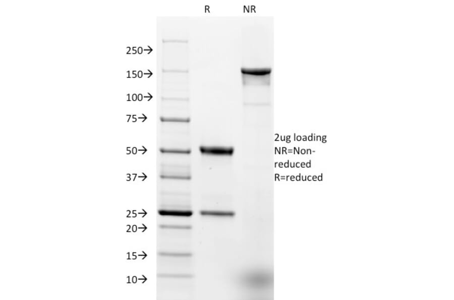 SDS-PAGE - Anti-EpCAM Antibody [EGP40/1384] - BSA and Azide free (A252428) - Antibodies.com