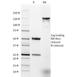 SDS-PAGE - Anti-EpCAM Antibody [EGP40/1384] - BSA and Azide free (A252428) - Antibodies.com