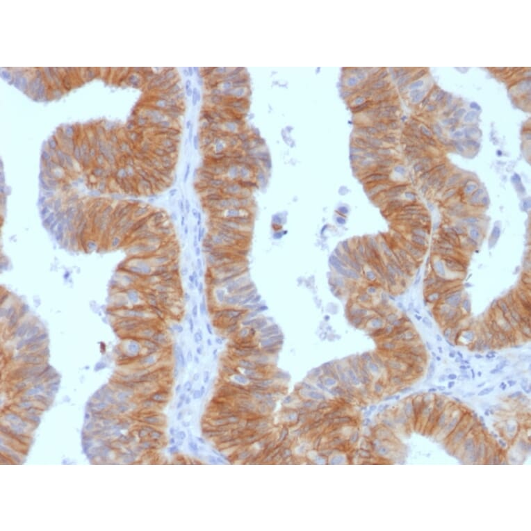 Immunohistochemistry - Anti-EpCAM Antibody [EGP40/1384] - BSA and Azide free (A252428) - Antibodies.com