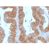Immunohistochemistry - Anti-EpCAM Antibody [EGP40/1384] - BSA and Azide free (A252428) - Antibodies.com