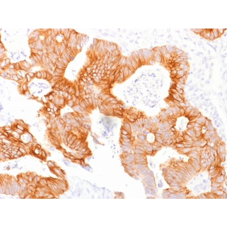 Immunohistochemistry - Anti-EpCAM Antibody [EGP40/1798] - BSA and Azide free (A252429) - Antibodies.com