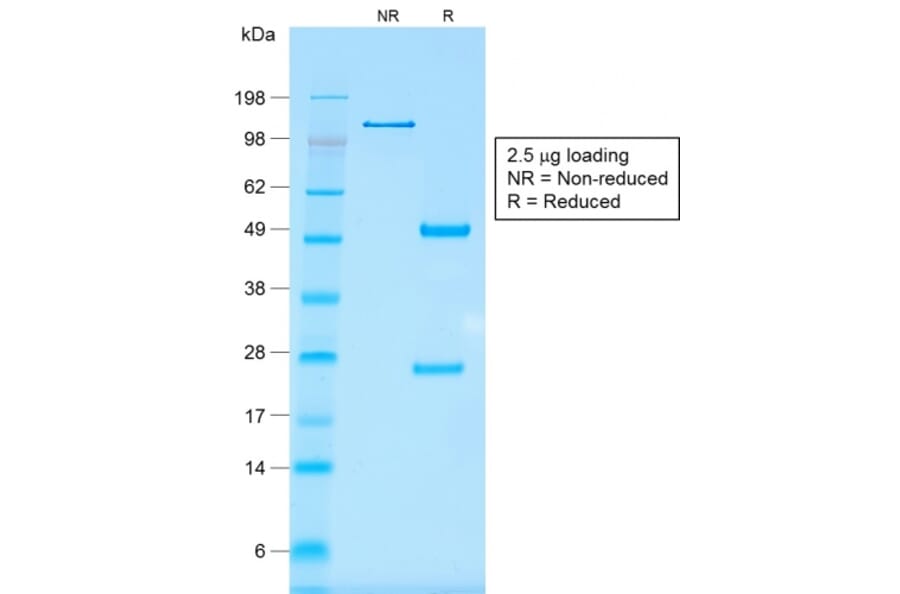 SDS-PAGE - Anti-EpCAM Antibody [rMOC-31] - BSA and Azide free (A252430) - Antibodies.com
