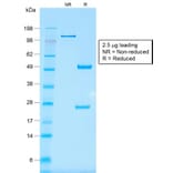 SDS-PAGE - Anti-EpCAM Antibody [rMOC-31] - BSA and Azide free (A252430) - Antibodies.com