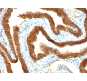 Immunohistochemistry - Anti-EpCAM Antibody [VU-1D9] - BSA and Azide free (A249251) - Antibodies.com