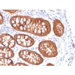 Immunohistochemistry - Anti-EpCAM Antibody [rVU-1D9] - BSA and Azide free (A249253) - Antibodies.com