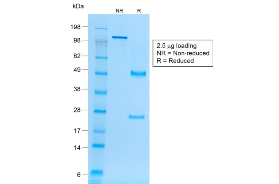 SDS-PAGE - Anti-EpCAM Antibody [rVU-1D9] - BSA and Azide free (A249253) - Antibodies.com