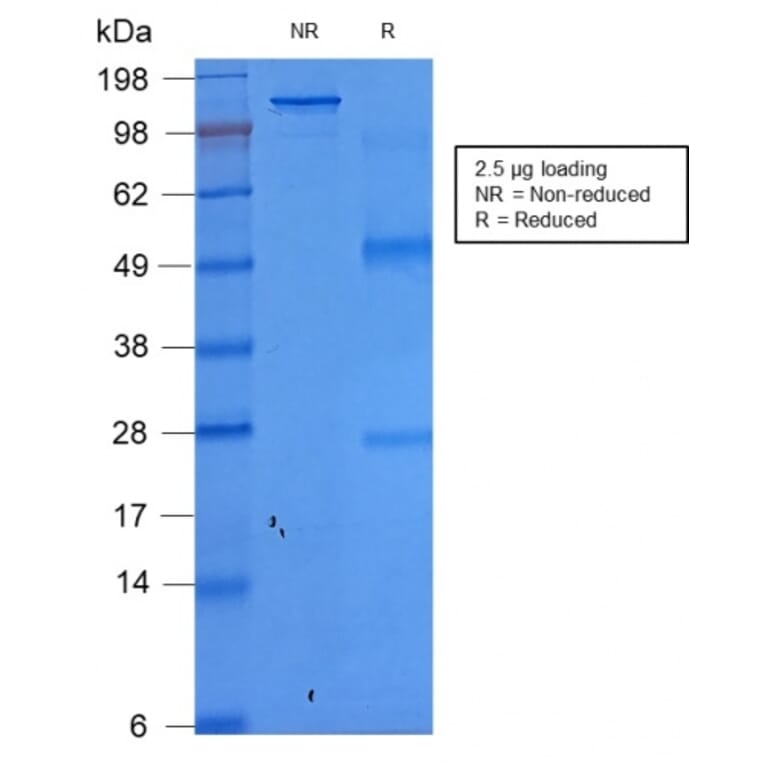 SDS-PAGE - Anti-EpCAM Antibody [rEGP40/1372] - BSA and Azide free (A252434) - Antibodies.com