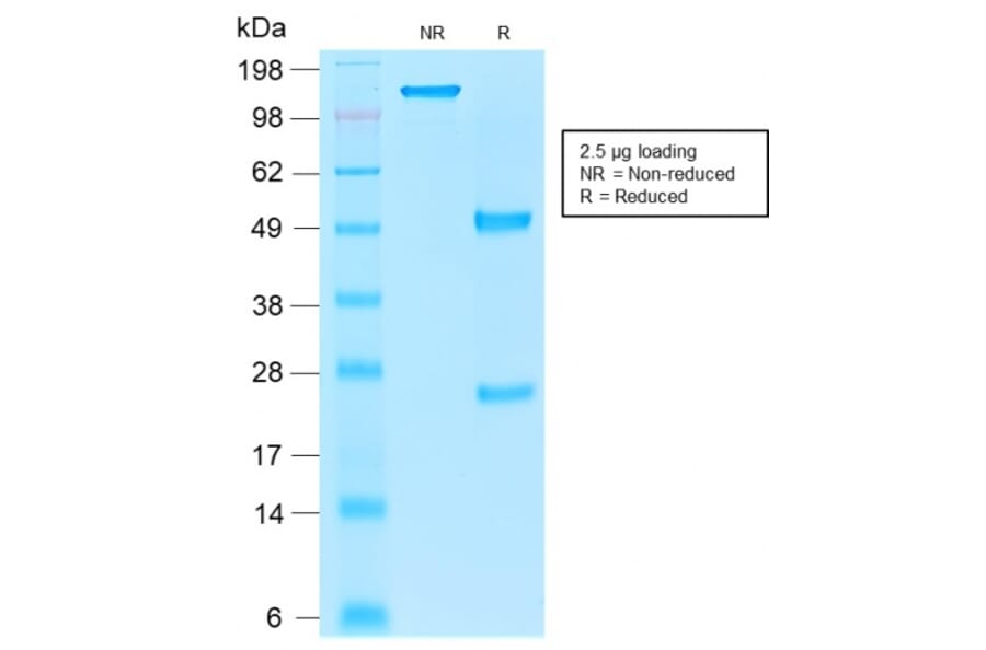 SDS-PAGE - Anti-EpCAM Antibody [rEGP40/1110] - BSA and Azide free (A252435) - Antibodies.com