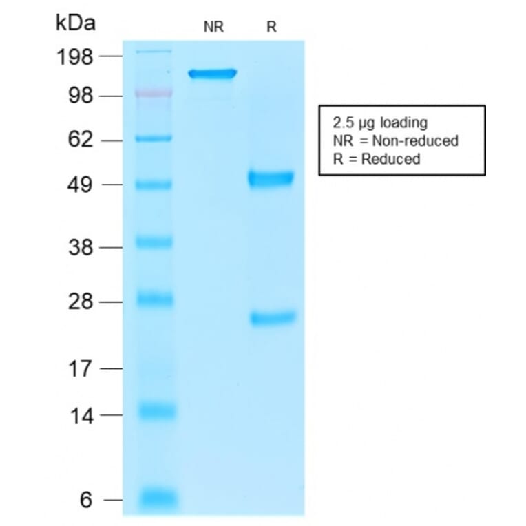 SDS-PAGE - Anti-EpCAM Antibody [rEGP40/1110] - BSA and Azide free (A252435) - Antibodies.com