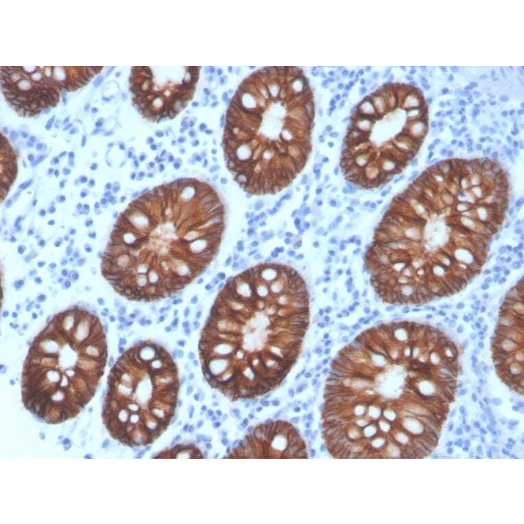 Immunohistochemistry - Anti-EpCAM Antibody [rEGP40/4547] - BSA and Azide free (A252436) - Antibodies.com
