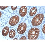 Immunohistochemistry - Anti-EpCAM Antibody [rEGP40/4547] - BSA and Azide free (A252436) - Antibodies.com