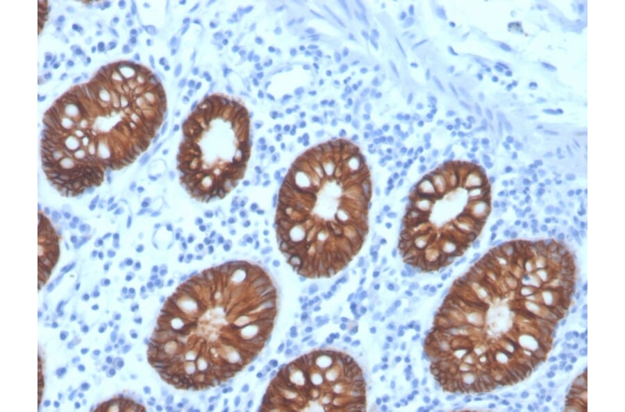 Immunohistochemistry - Anti-EpCAM Antibody [rEGP40/4547] - BSA and Azide free (A249256) - Antibodies.com
