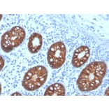 Immunohistochemistry - Anti-EpCAM Antibody [rEGP40/4547] - BSA and Azide free (A249256) - Antibodies.com